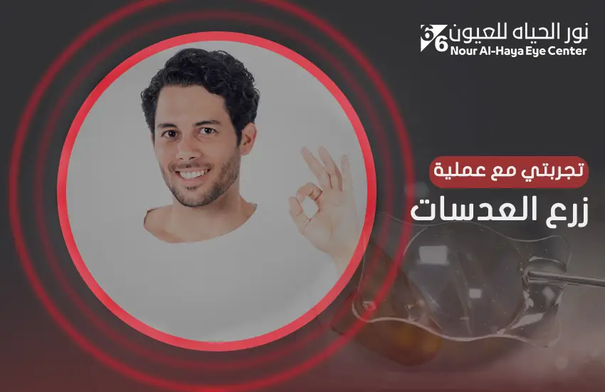 تجربتي مع عملية زراعة العدسات