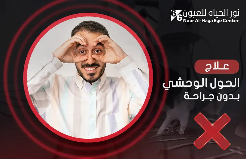 علاج الحول الوحشي بدون جراحة