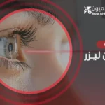 عملية أرجون ليزر