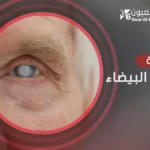 عملية المياه البيضاء 
