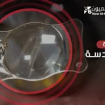 أحدث تقنيات عملية زرع عدسة العين