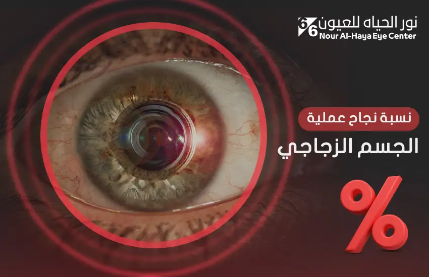 نسبة نجاح عملية الجسم الزجاجي